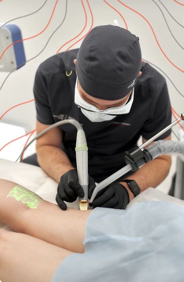 Удаление варикоза